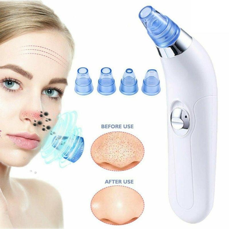 Electric Pore Export Blackhead Cleaner