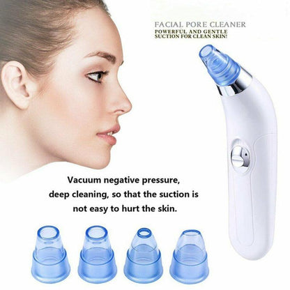 Electric Pore Export Blackhead Cleaner